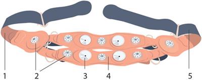 A Novel, Cardiac-Derived Algorithm for Uterine Activity Monitoring in a Wearable Remote Device